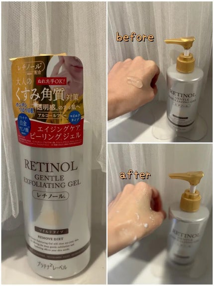 プラチナレーベル レチノール(*2)配合ピーリングジェル/プラチナレーベル/ピーリングを使ったクチコミ(2枚目)