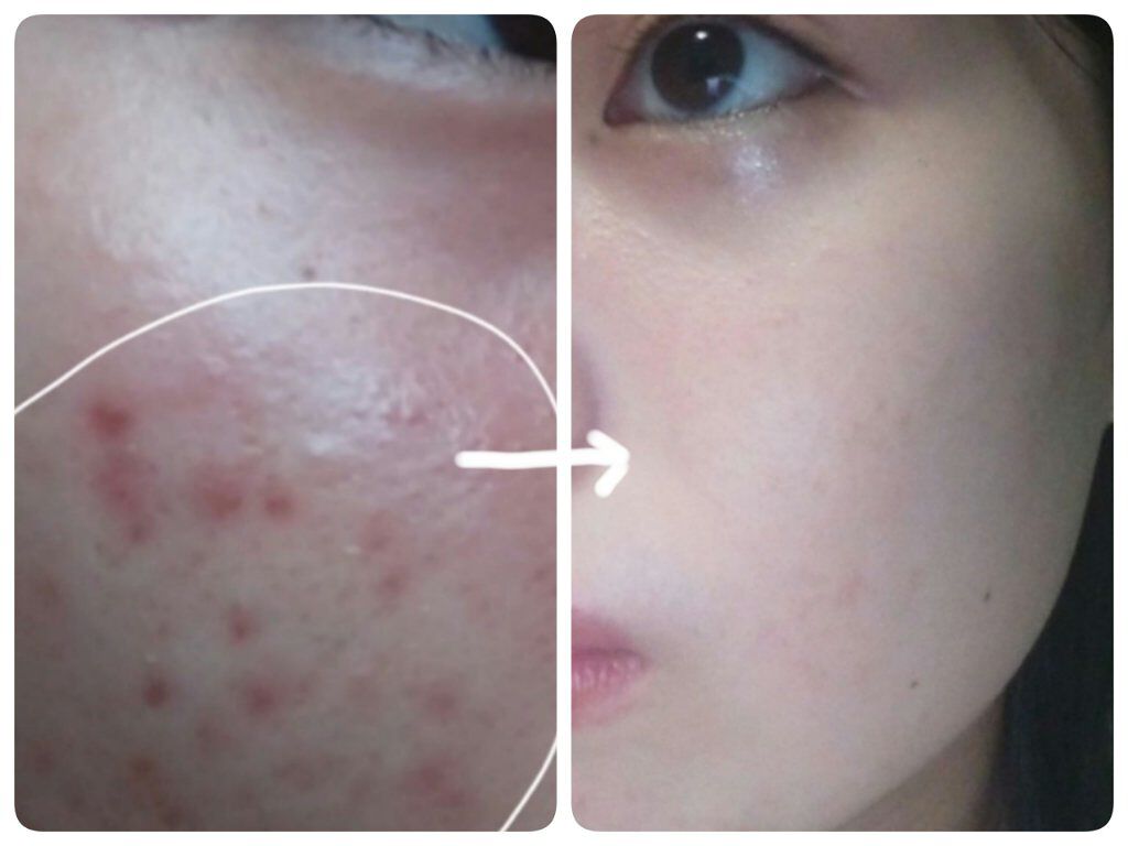 ハトムギ化粧水(ナチュリエ スキンコンディショナー R )/ナチュリエ/化粧水を使ったクチコミ（2枚目）