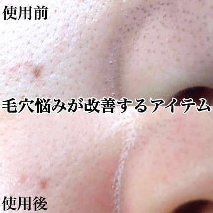 エッセンシャルジェル/Koo/マッサージクリームを使ったクチコミ(1枚目)