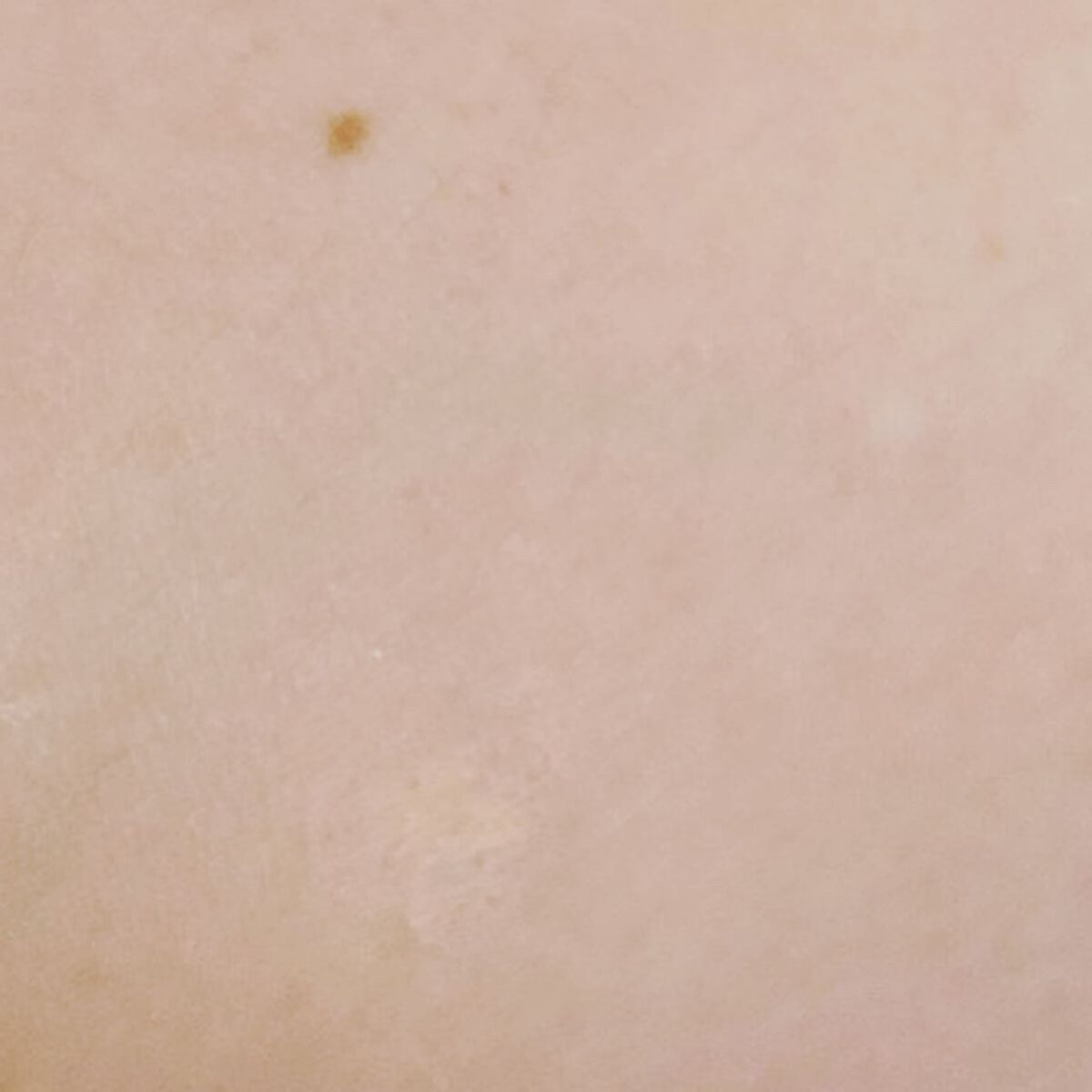 コンシーラー(シミ・ソバカス用) ライトベージュ/グレイシィ/スティックコンシーラーを使ったクチコミ（3枚目）