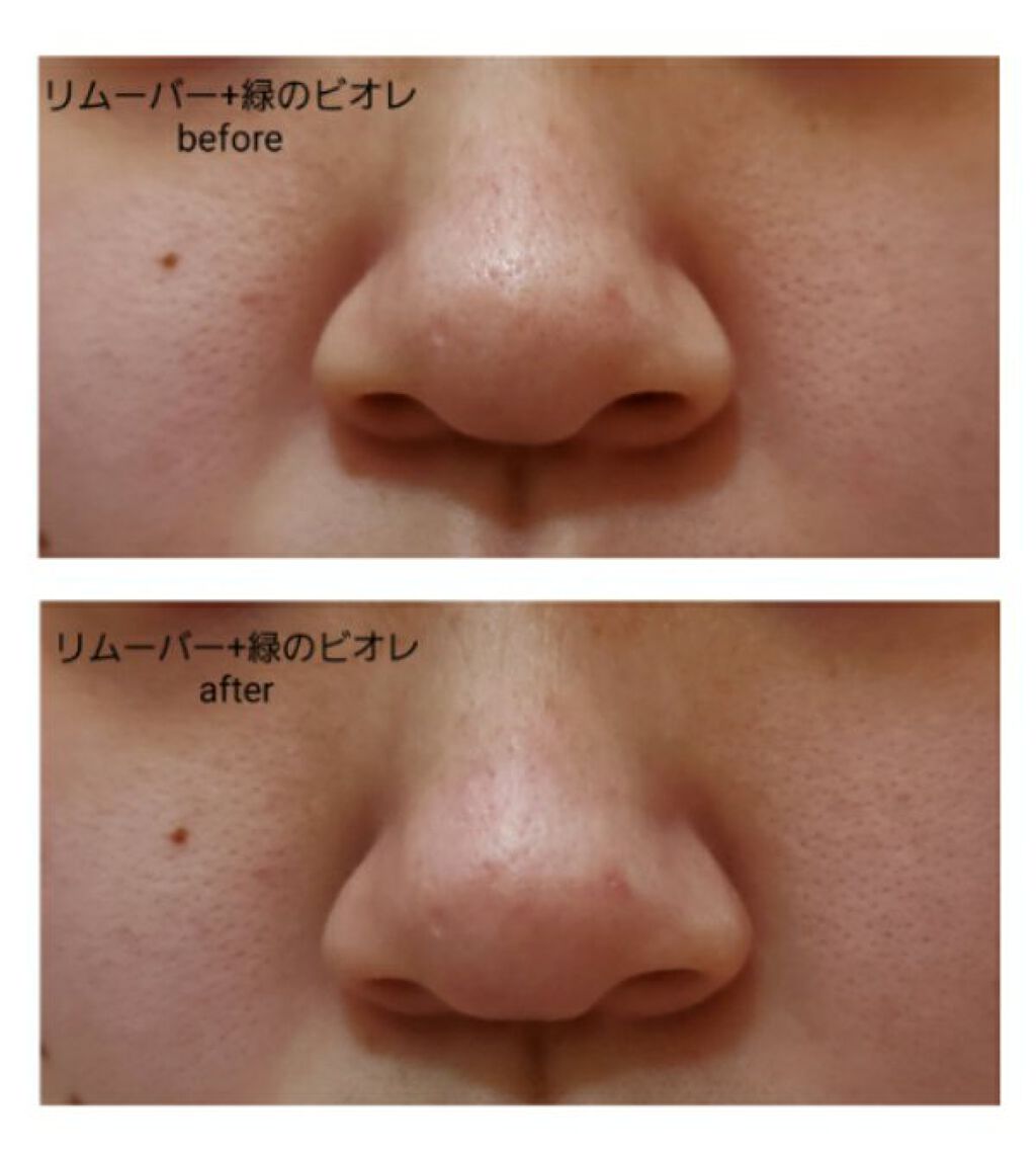 エマルジョンリムーバー 300ml/200ml/水橋保寿堂製薬/その他洗顔料を使ったクチコミ(3枚目)