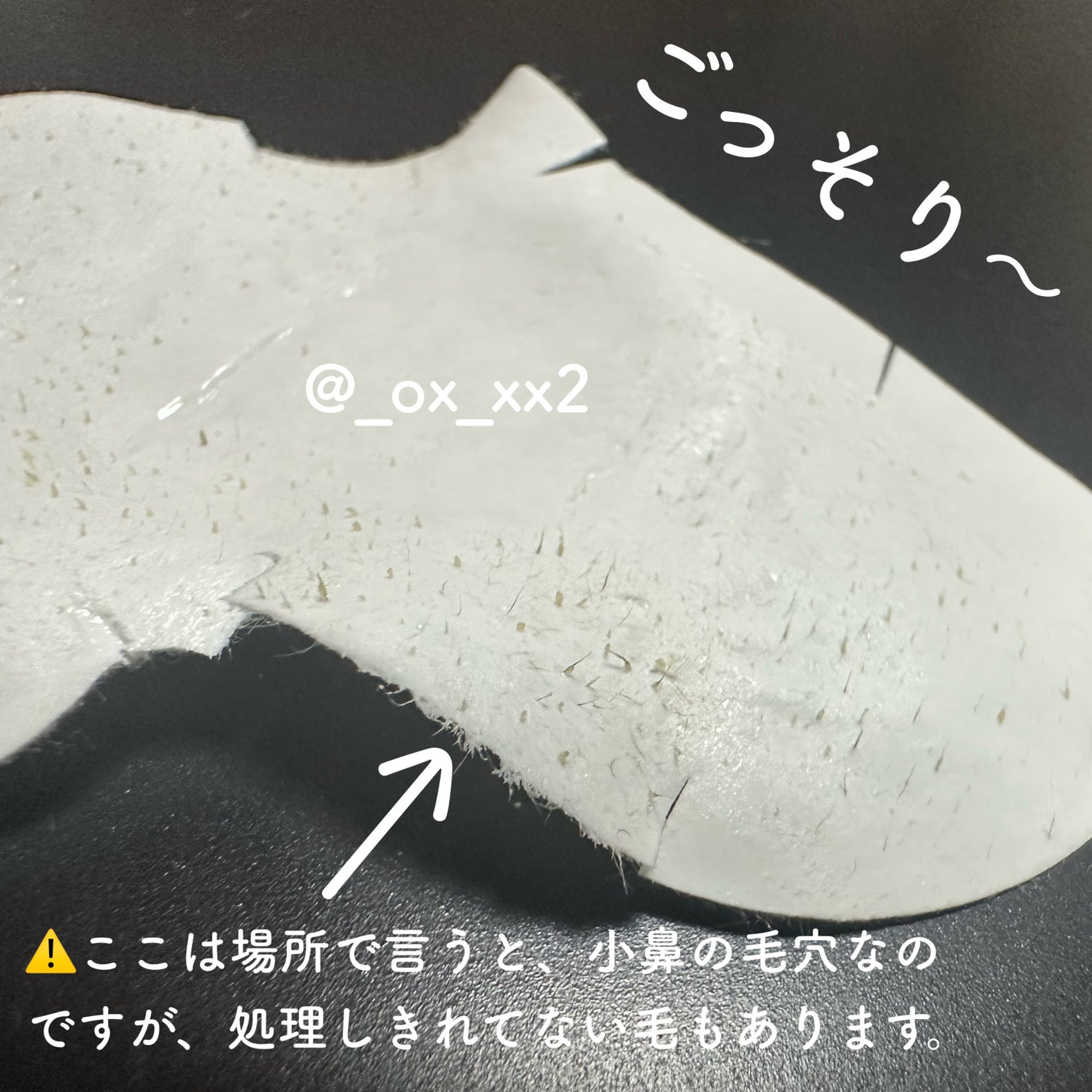 ピギーノーズストリップ/MEFACTORY/シートマスク・パックを使ったクチコミ(4枚目)