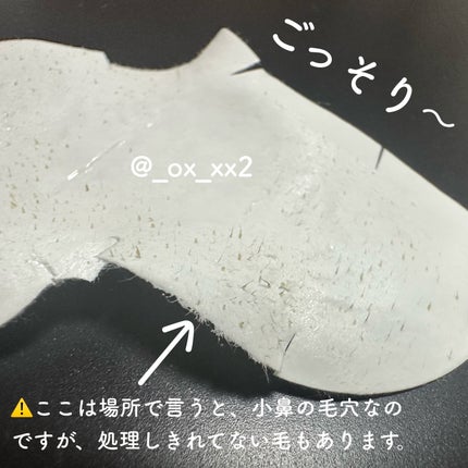 ピギーノーズストリップ/MEFACTORY/シートマスク・パックを使ったクチコミ(4枚目)