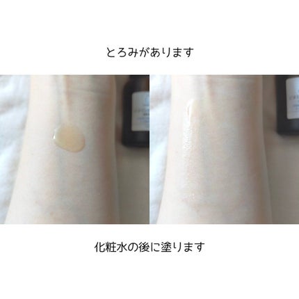 タカミスキンピール/タカミ/ブースター・導入液を使ったクチコミ(5枚目)