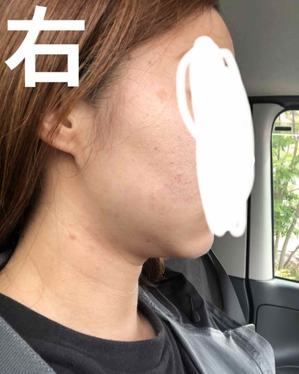 chibi_na on LIPS 「まだ汚いけど、これだけきれいになった😳1、2枚目は今日の写真3..」(1枚目)