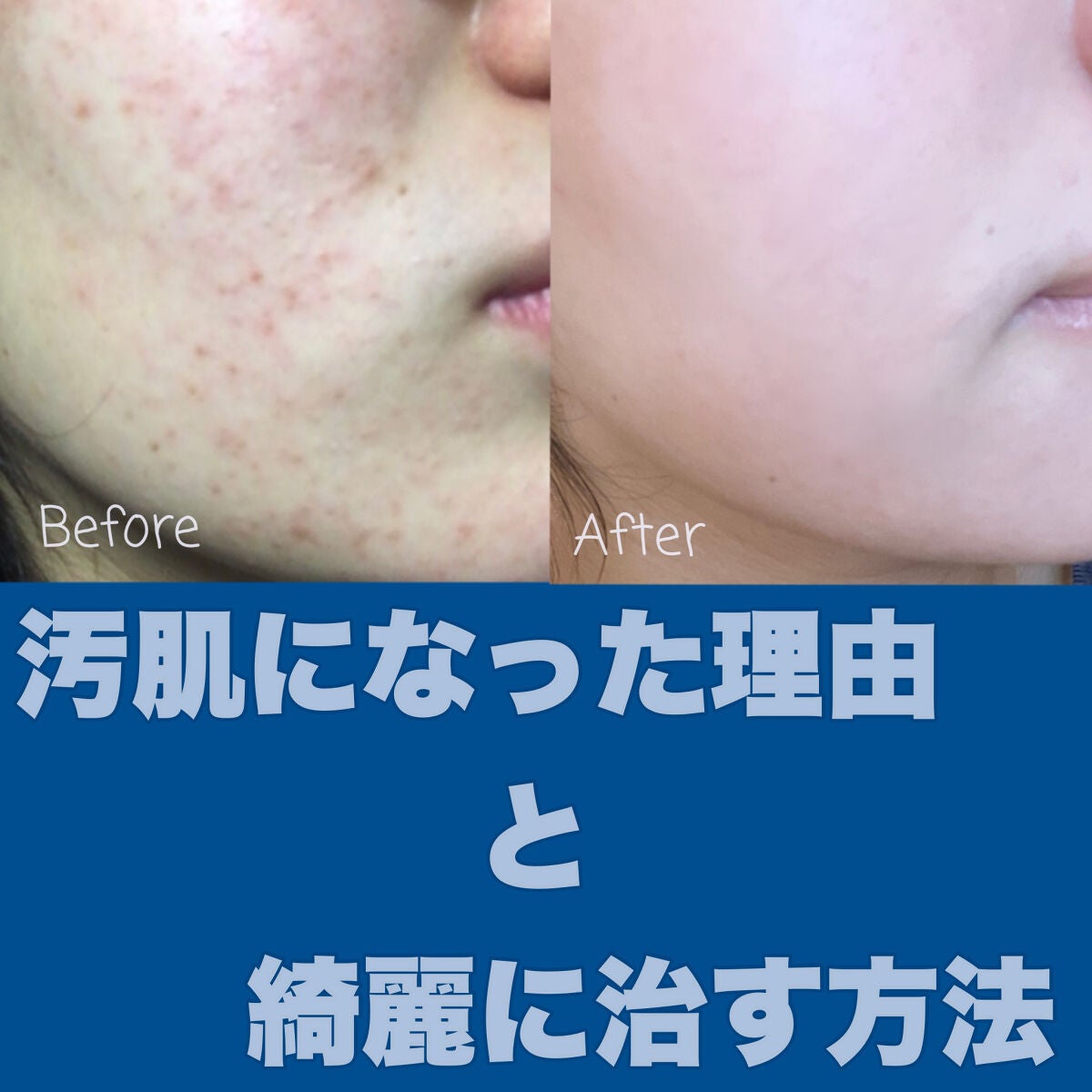 化粧水 敏感肌用 さっぱりタイプ/無印良品/化粧水を使ったクチコミ(1枚目)