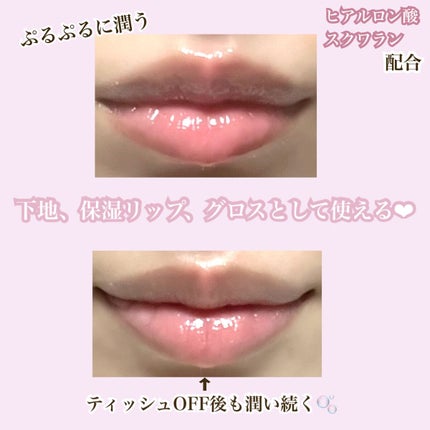 エッセンス リッププランパー/Visée/リッププランパーを使ったクチコミ(2枚目)