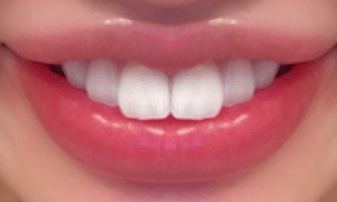 colgate コルゲート オプティックホワイトのクチコミ「コルゲートのオプティックホワイトニングの中で
一番効果が高いとされる、
ハイインパクトホワイト.....」（2枚目）