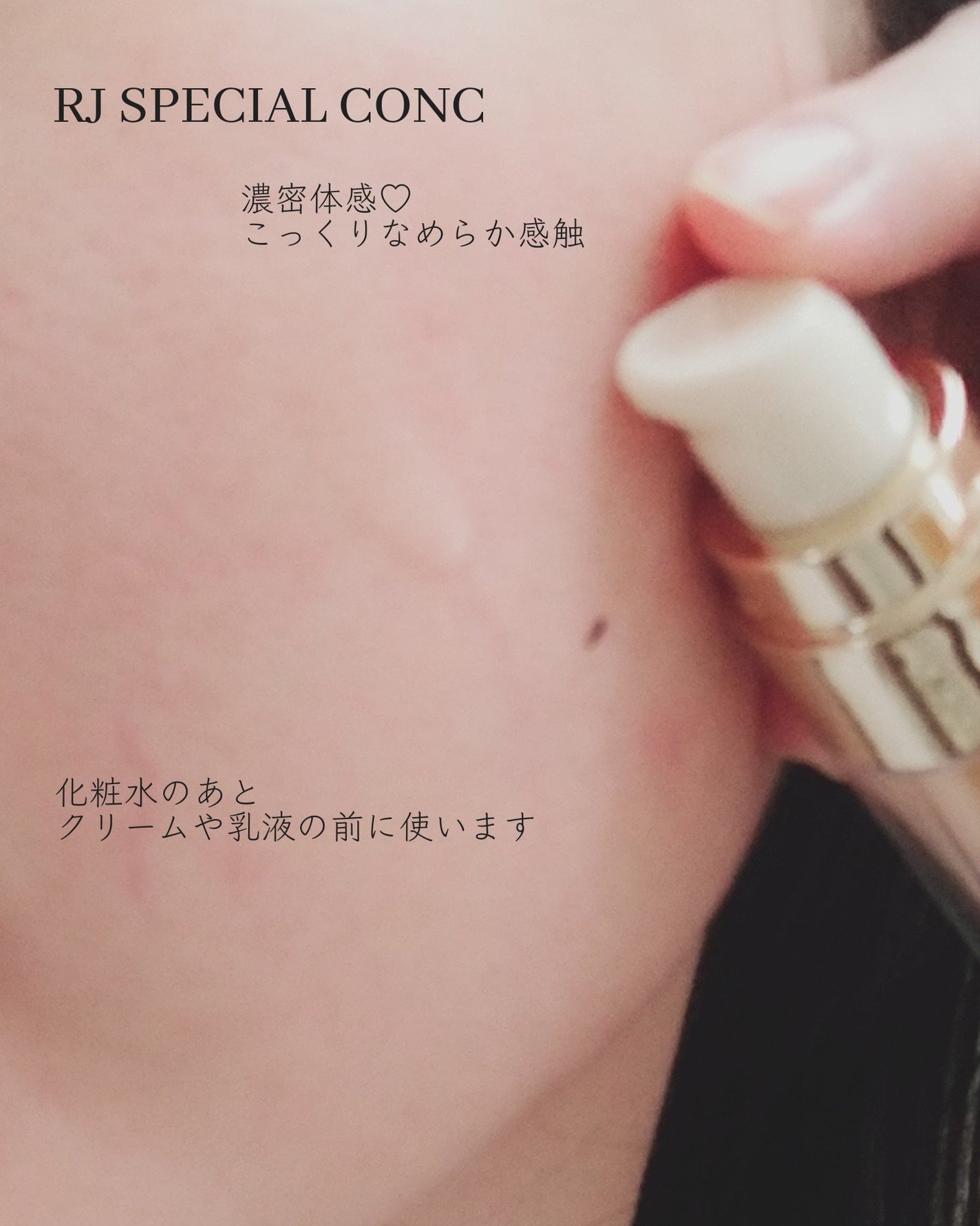 RJスペシャルコンク/アピセラピーコスメティクス/美容液を使ったクチコミ(5枚目)