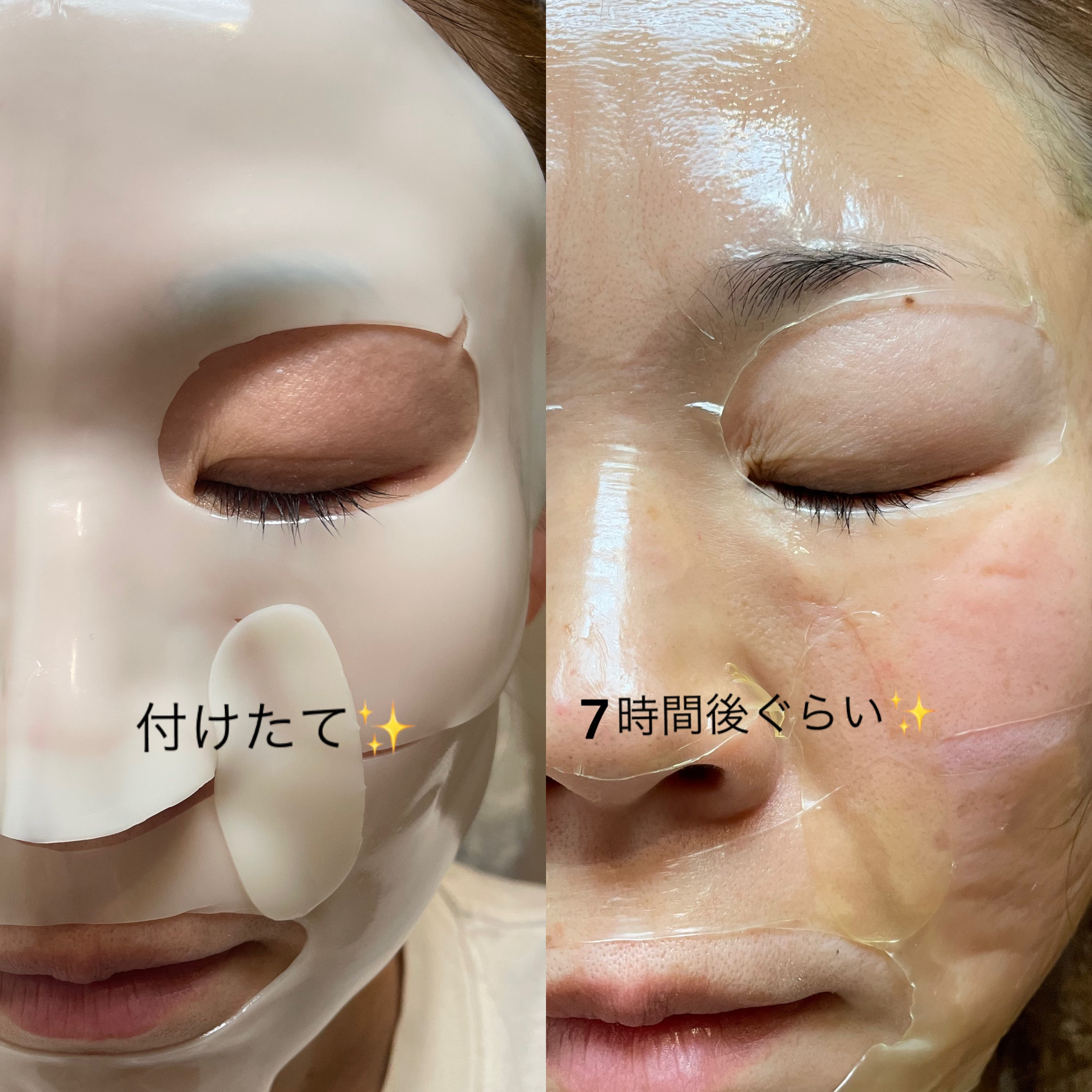 ビタナイアシンアミド リアルディープマスク/Biodance/シートマスク・パックを使ったクチコミ（3枚目）