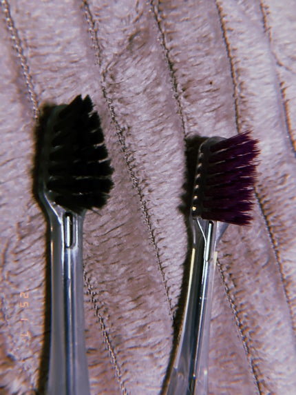 マイナスイオン歯ブラシ/KISS YOU/歯ブラシを使ったクチコミ(5枚目)