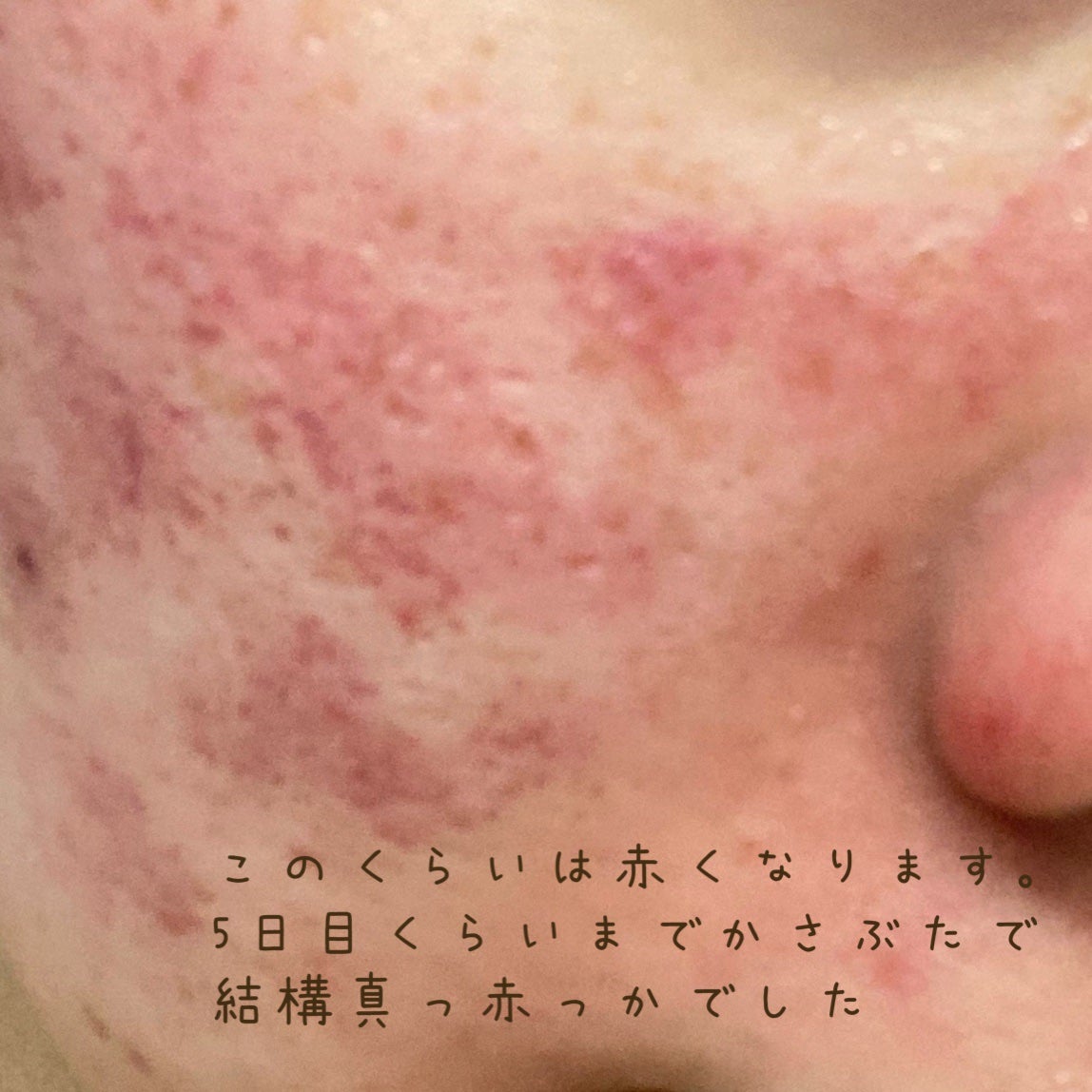 ãŽãããð¥ãã©ãã100 on LIPS ãããŒããã³ã£ãŠã¯ã¬ãŒã¿ãŒå®æ²»ããã®ïŒïŒèã£ãŠæ¬åœã«éºäŒãšãäœè³ª..ãïŒ2æç®ïŒ