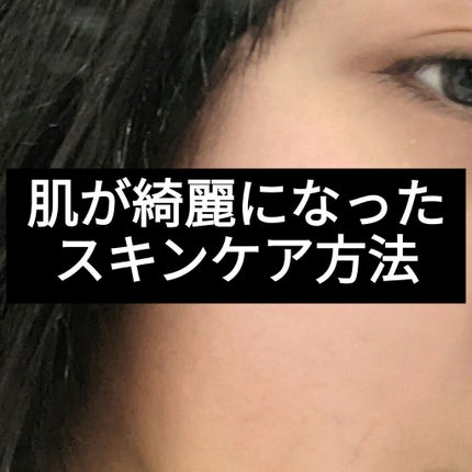 ハトムギ化粧水(ナチュリエ スキンコンディショナー R )/ナチュリエ/化粧水を使ったクチコミ(1枚目)