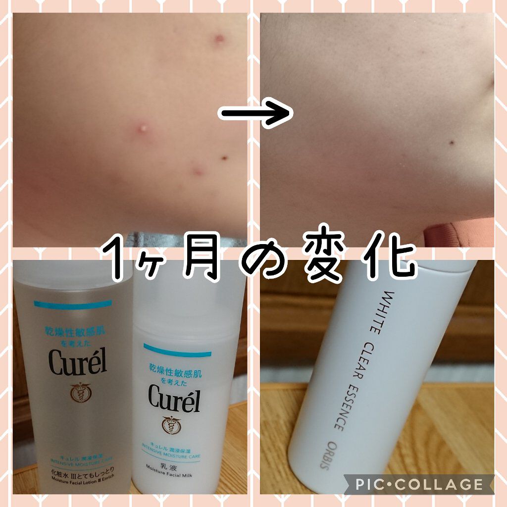 潤浸保湿 乳液/キュレル/乳液を使ったクチコミ（1枚目）