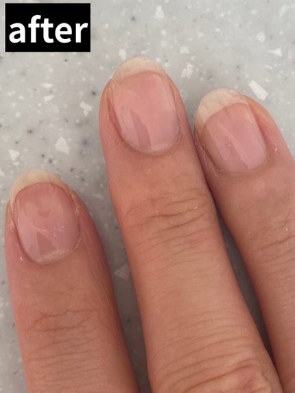 ネイルセラム/innisfree/ネイルオイル・トリートメントを使ったクチコミ(5枚目)