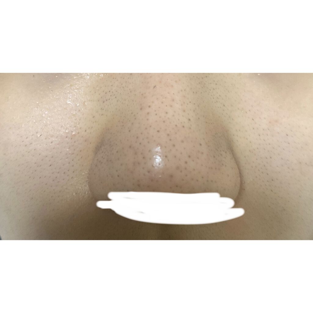 デュオ ザ クレンジングバーム クリア/DUO/クレンジングバームを使ったクチコミ（2枚目）