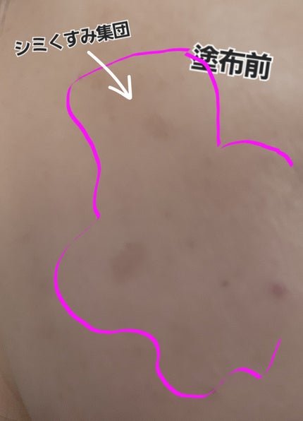 スキッチ スポットレタッチファンデ/エリザベス/パレットコンシーラーを使ったクチコミ(4枚目)