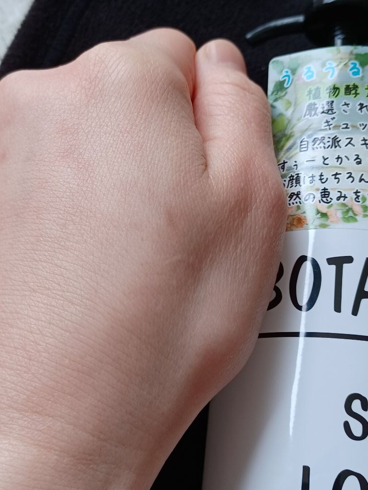 ボタニカル スキンローション/ボタニカル/化粧水を使ったクチコミ(2枚目)