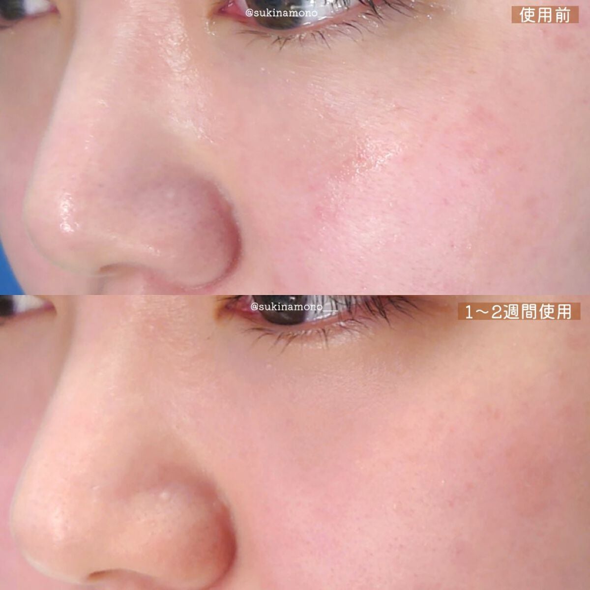 スキンコンディショナー/シェルミラック/頭皮ケアを使ったクチコミ(4枚目)