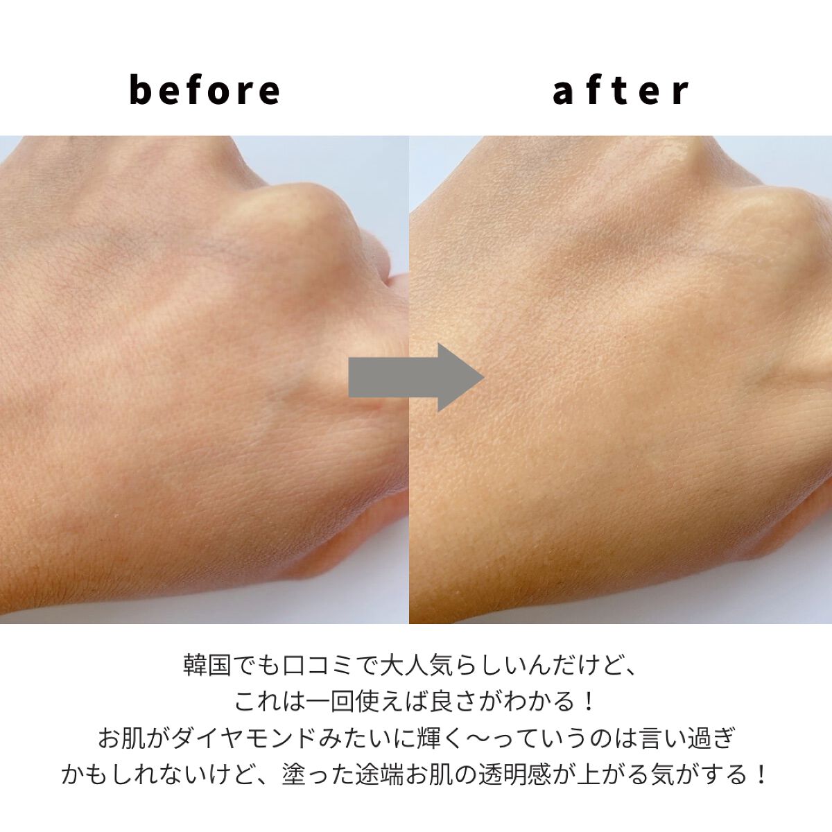 ブレミッシュケアアップ セラム/ISOI/美容液を使ったクチコミ(3枚目)