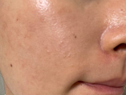 Misað¶ on LIPS ãããŒããã³45æ¥ç®çµéèãåç²§äžå°äŒžã°ããšãœããœãå¥ããããã..ãïŒ1æç®ïŒ