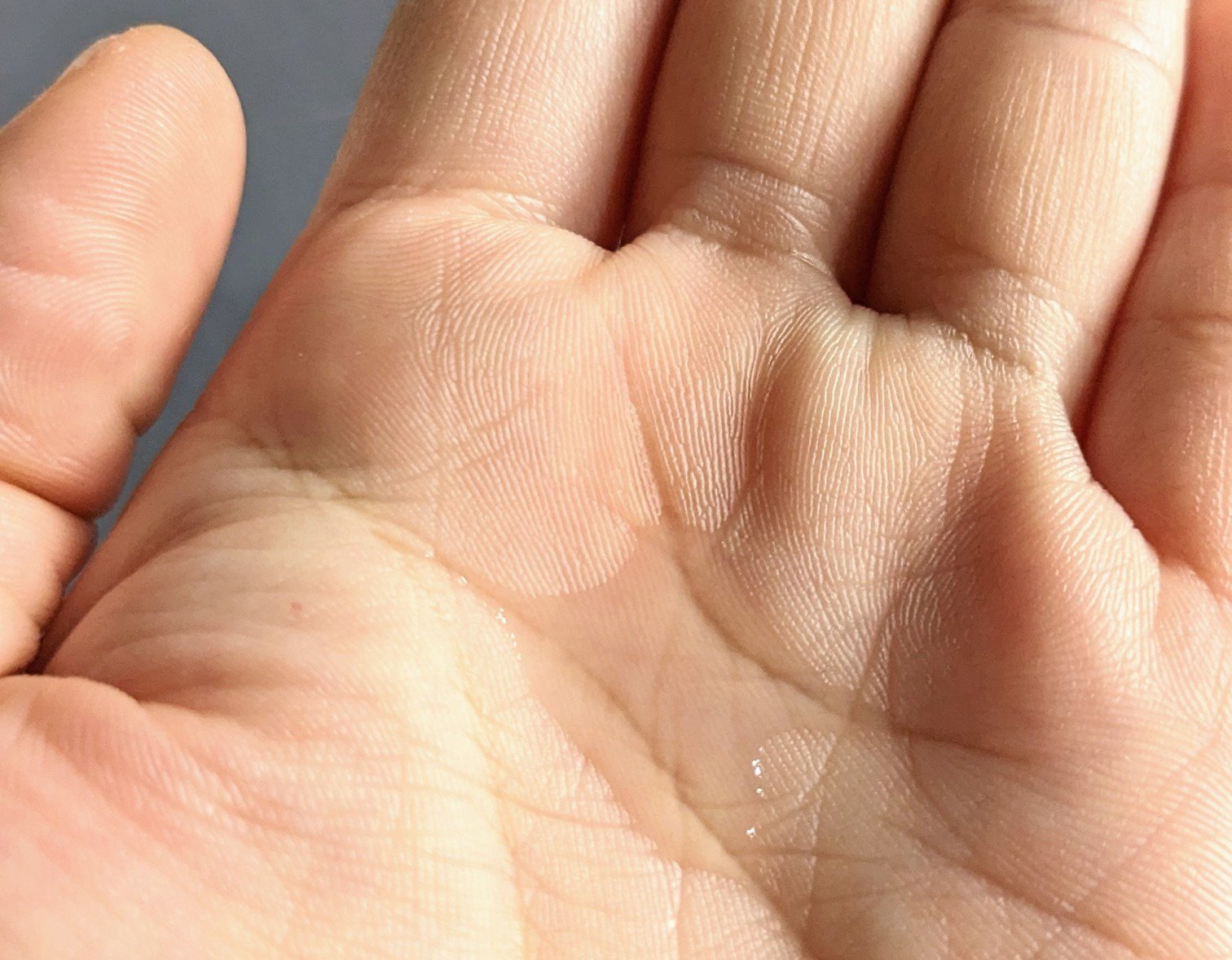 マグワートファーストキット/mgb skin/スキンケアキットを使ったクチコミ（3枚目）