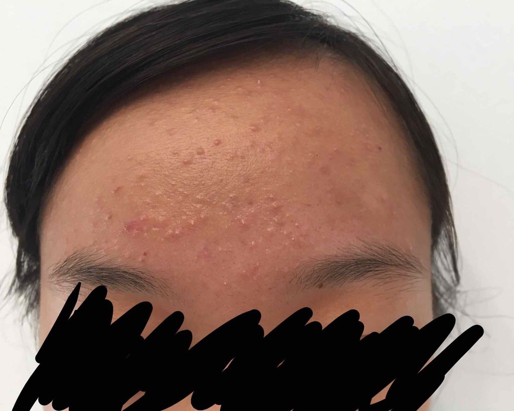 ハトムギ化粧水(ナチュリエ スキンコンディショナー R )/ナチュリエ/化粧水を使ったクチコミ（2枚目）