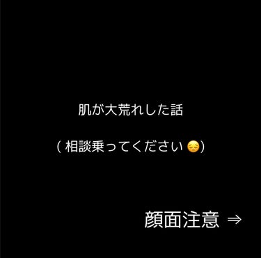 スピーディーパーフェクトホイップ モイストタッチ/SENKA（専科）/泡洗顔を使ったクチコミ（1枚目）