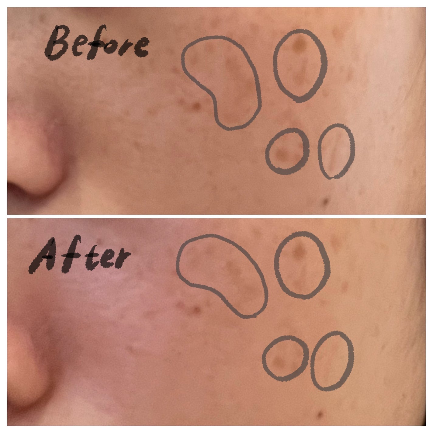 リードルショット100/VT/美容液を使ったクチコミ(4枚目)