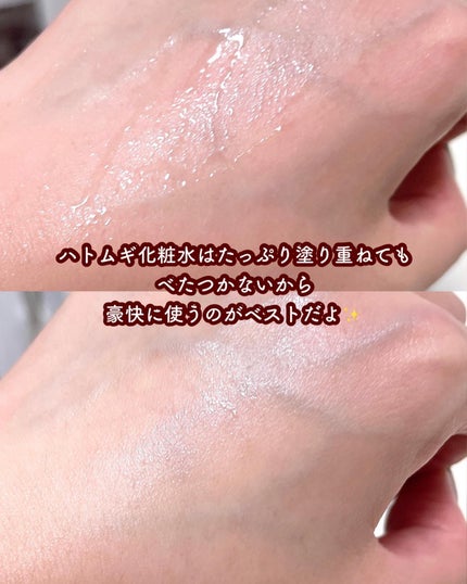 ハトムギ化粧水(ナチュリエ スキンコンディショナー R )/ナチュリエ/化粧水を使ったクチコミ(5枚目)