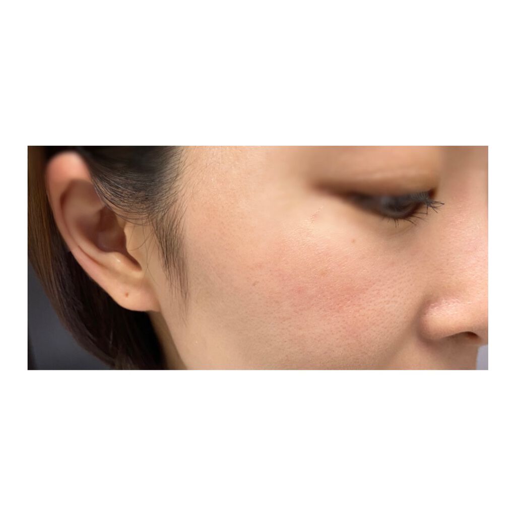 ハイライタークチュール/YVES SAINT LAURENT BEAUTE/パウダーハイライトを使ったクチコミ(3枚目)