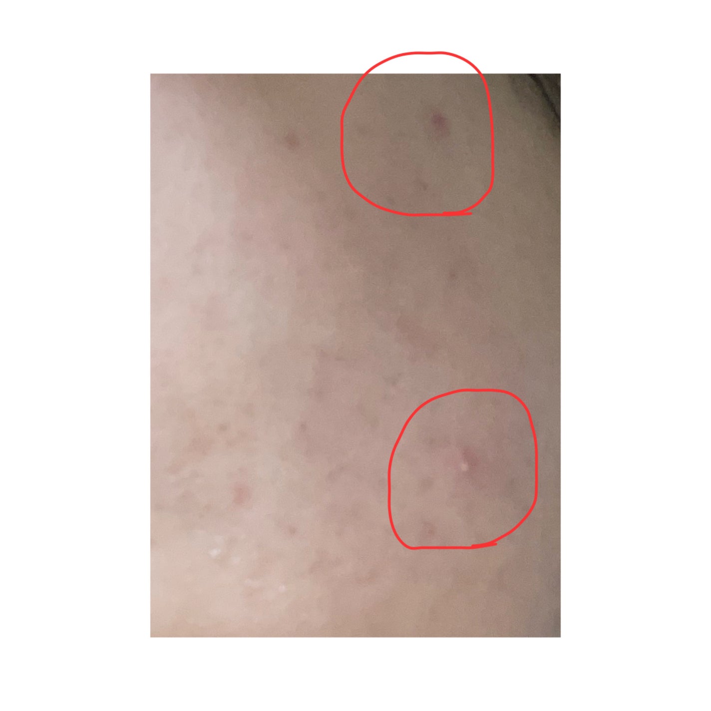 ごめんね素肌 キニナルマスク/クリアターン/シートマスク・パックを使ったクチコミ(3枚目)