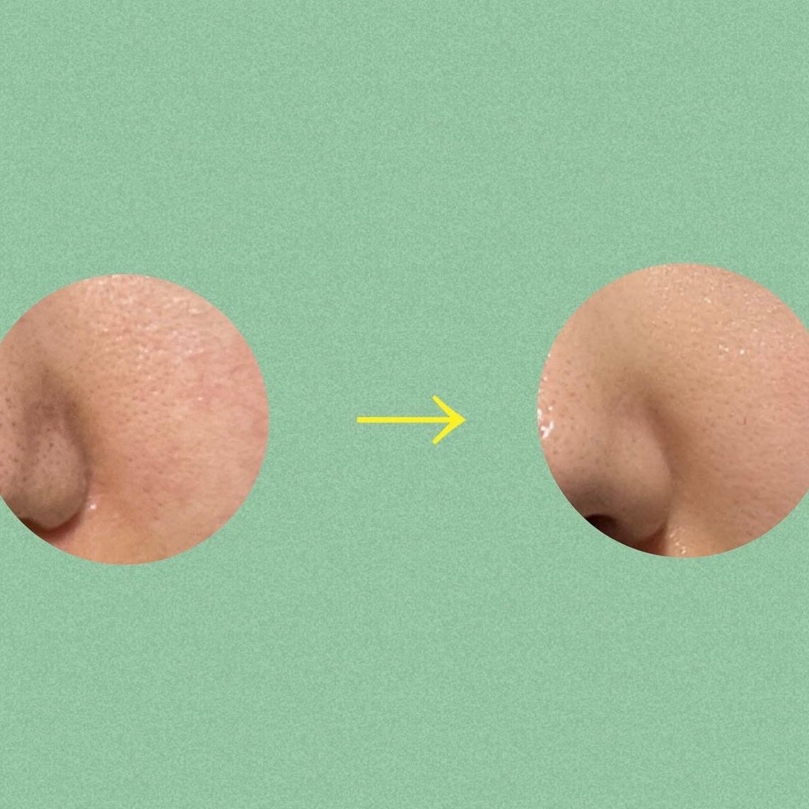 シカレチA エッセンス0.1/VT/美容液を使ったクチコミ(3枚目)