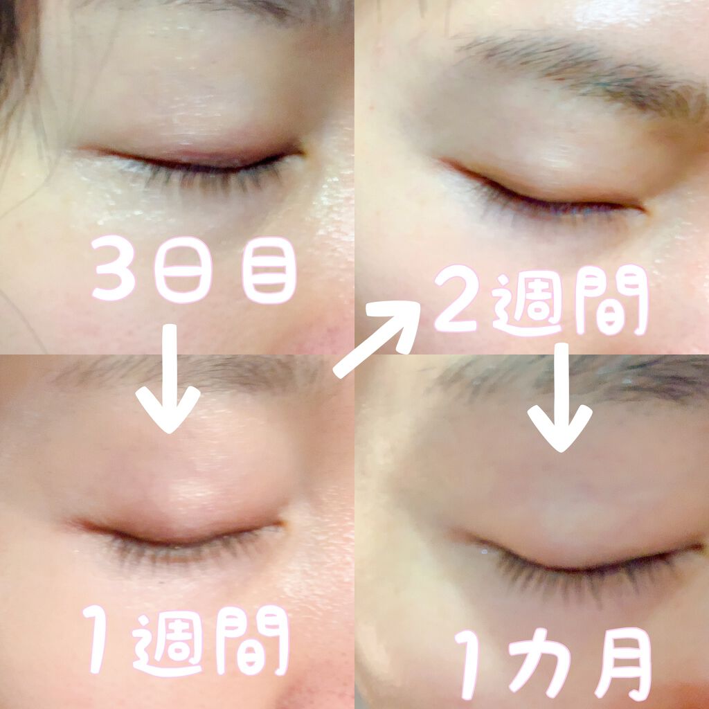 EMAKED（エマーキット）/水橋保寿堂製薬/まつげ美容液を使ったクチコミ（2枚目）