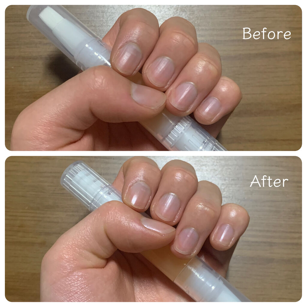 ネイルケアオイル/無印良品/ネイルオイル・トリートメントを使ったクチコミ（2枚目）