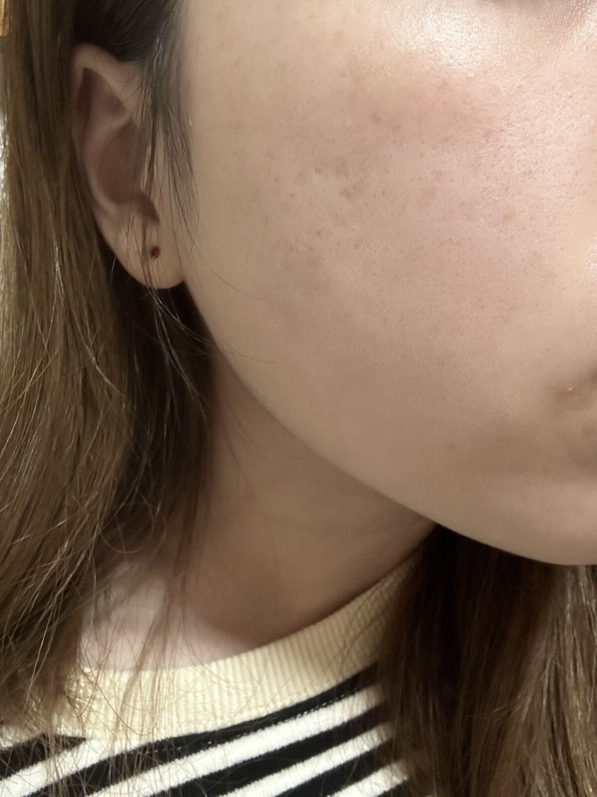 エッセンス ミルキークリーム (しっとり)/アルージェ/フェイスクリームを使ったクチコミ（2枚目）