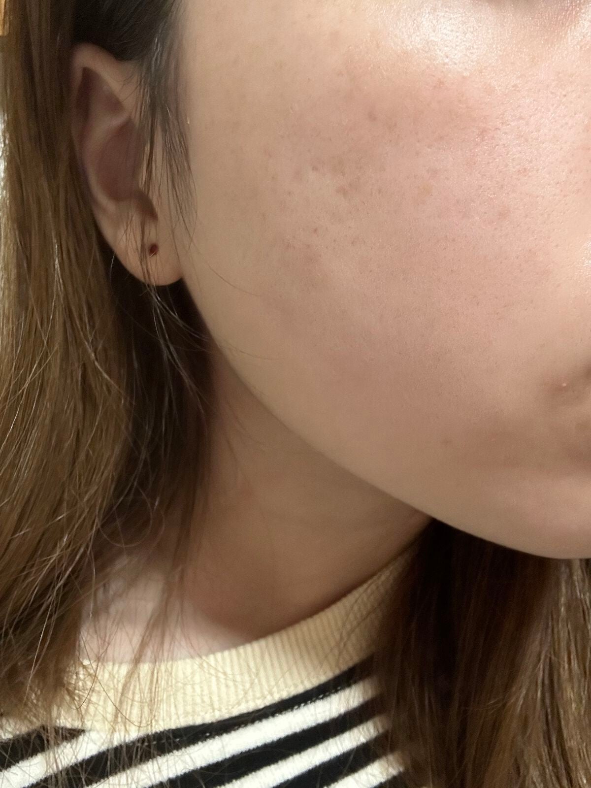 エッセンス ミルキークリーム (しっとり)/アルージェ/フェイスクリームを使ったクチコミ(2枚目)