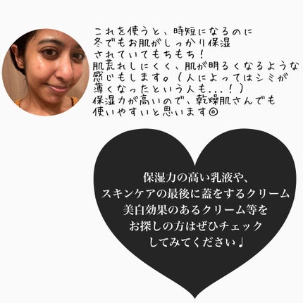 薬用ホワイトニングリペアクリームEX/トランシーノ/フェイスクリームを使ったクチコミ(4枚目)