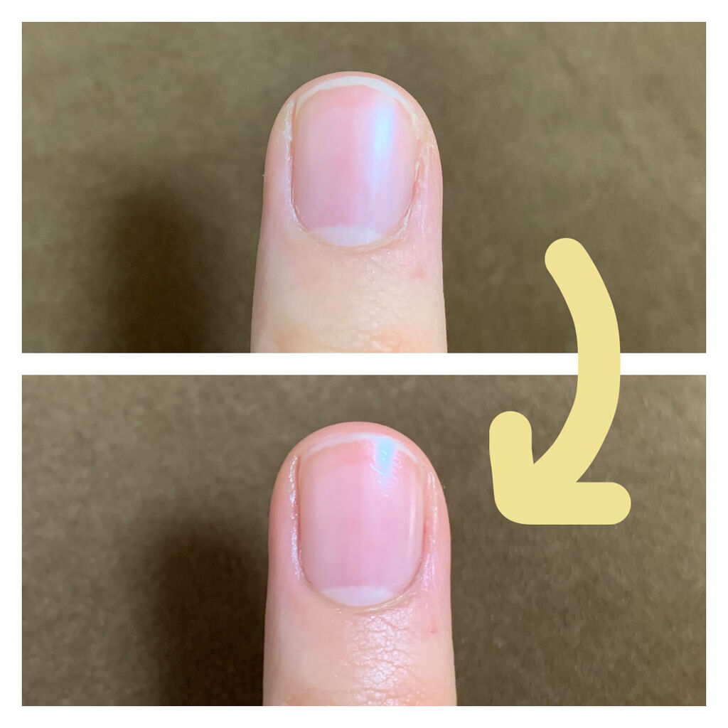 馬油/イオン/その他スキンケアを使ったクチコミ（2枚目）