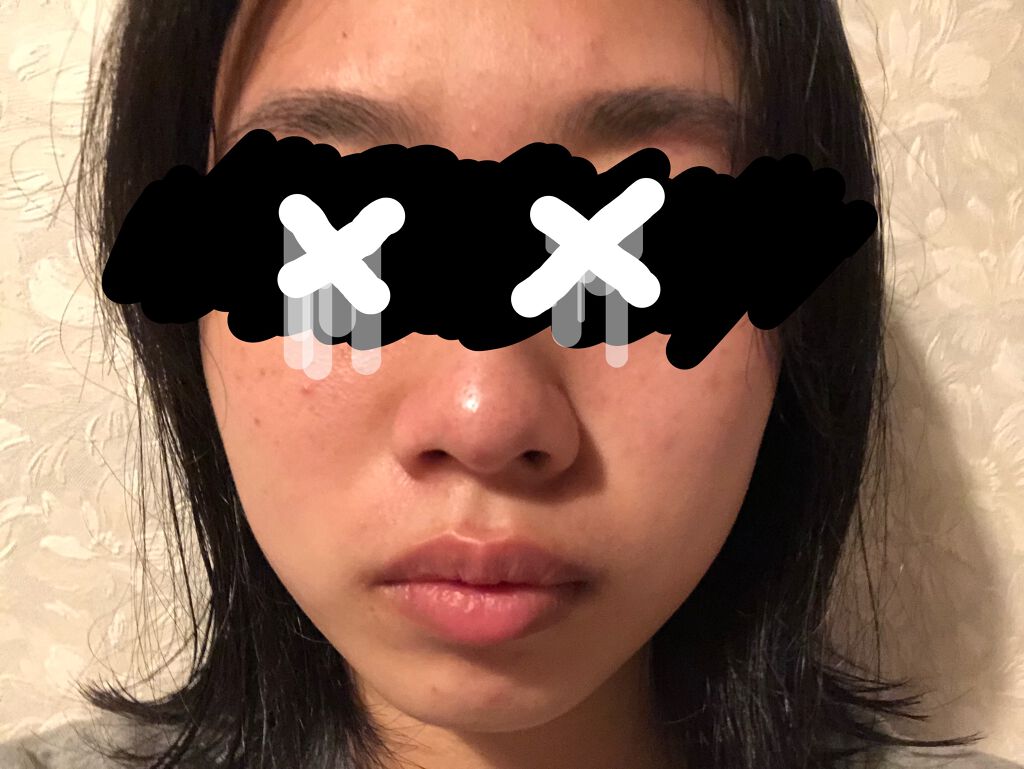 艶肌ドロップ/ラッシュ/美容液を使ったクチコミ(4枚目)