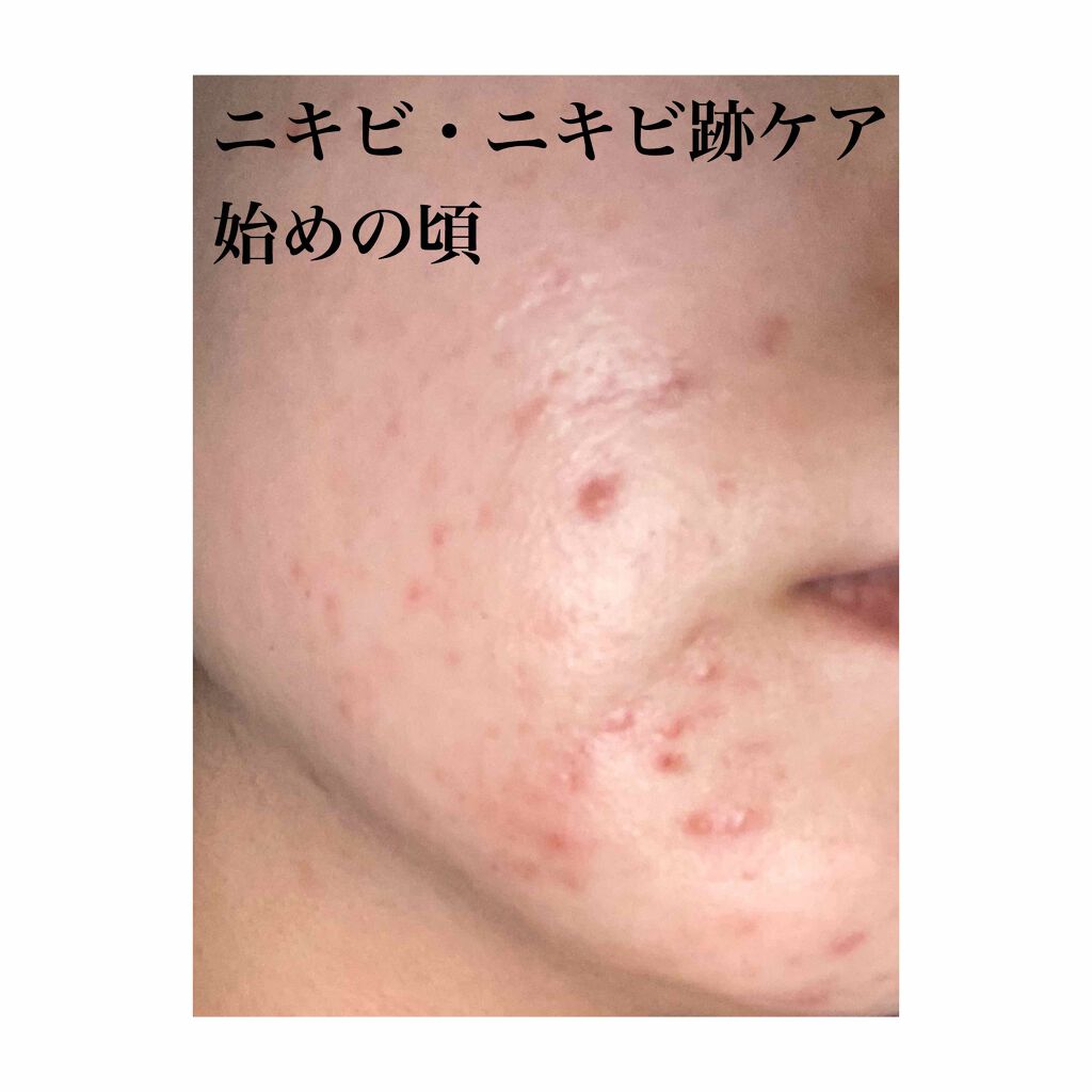 ハトムギ保湿ジェル(ナチュリエ スキンコンディショニングジェル)/ナチュリエ/美容液を使ったクチコミ（2枚目）