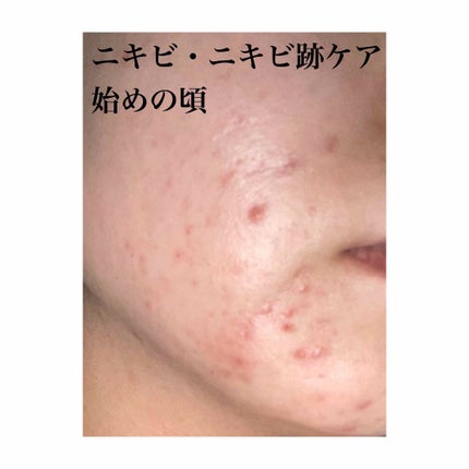ハトムギ保湿ジェル(ナチュリエ スキンコンディショニングジェル)/ナチュリエ/美容液を使ったクチコミ(2枚目)