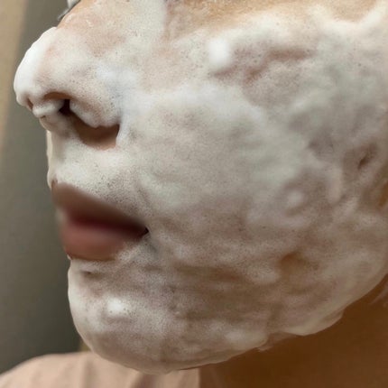 ドクダミオートバブルウォッシュオフマスクパック/be the skin/洗い流すパック・マスクを使ったクチコミ(6枚目)