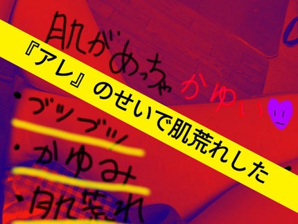 トップバリュ アロエスキンクリームのクチコミ「私はこのクリームとの相性が悪い……( ͒ ̶ ͒ )
私、あるクリームで肌荒れな.....」(1枚目)