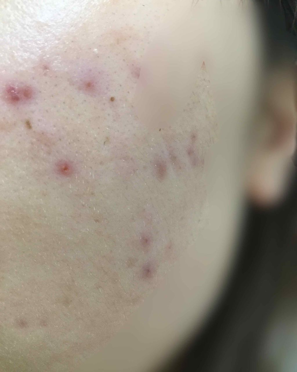 トライアルキット/シェルクルール/トライアルキットを使ったクチコミ(3枚目)