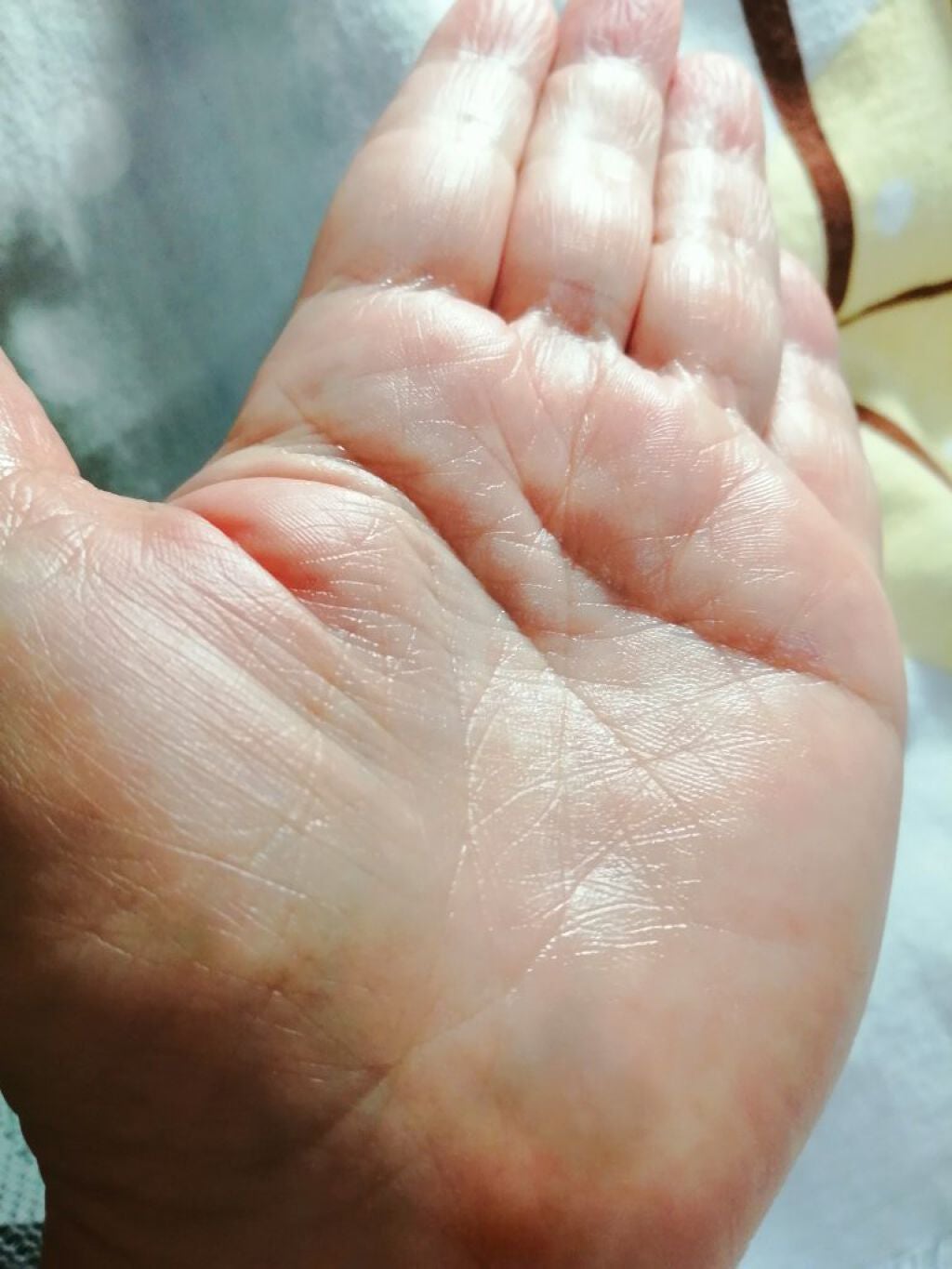 モイスチュア ローション/カルテHD/化粧水を使ったクチコミ(4枚目)