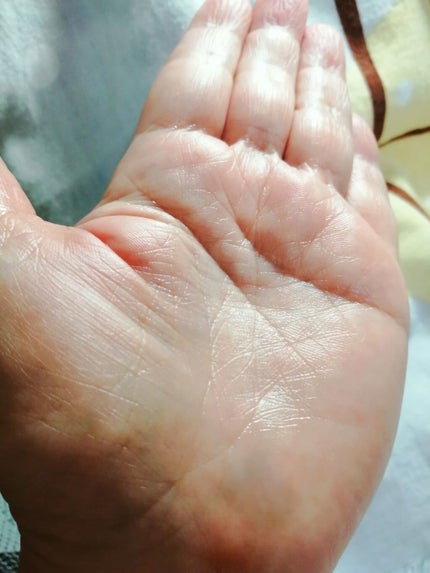 モイスチュア ローション/カルテHD/化粧水を使ったクチコミ(4枚目)