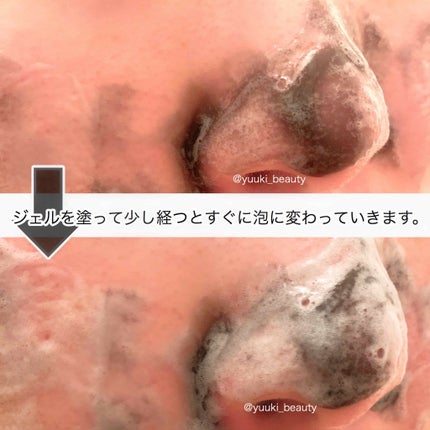 JUSO KURO PACK/NAKUNA-RE/洗い流すパック・マスクを使ったクチコミ(3枚目)