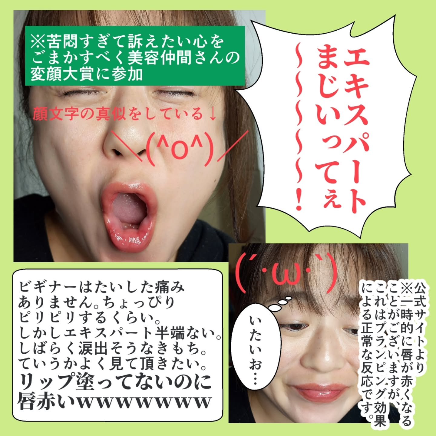 リードルS リッププランパービギナー/VT/リッププランパーを使ったクチコミ（3枚目）