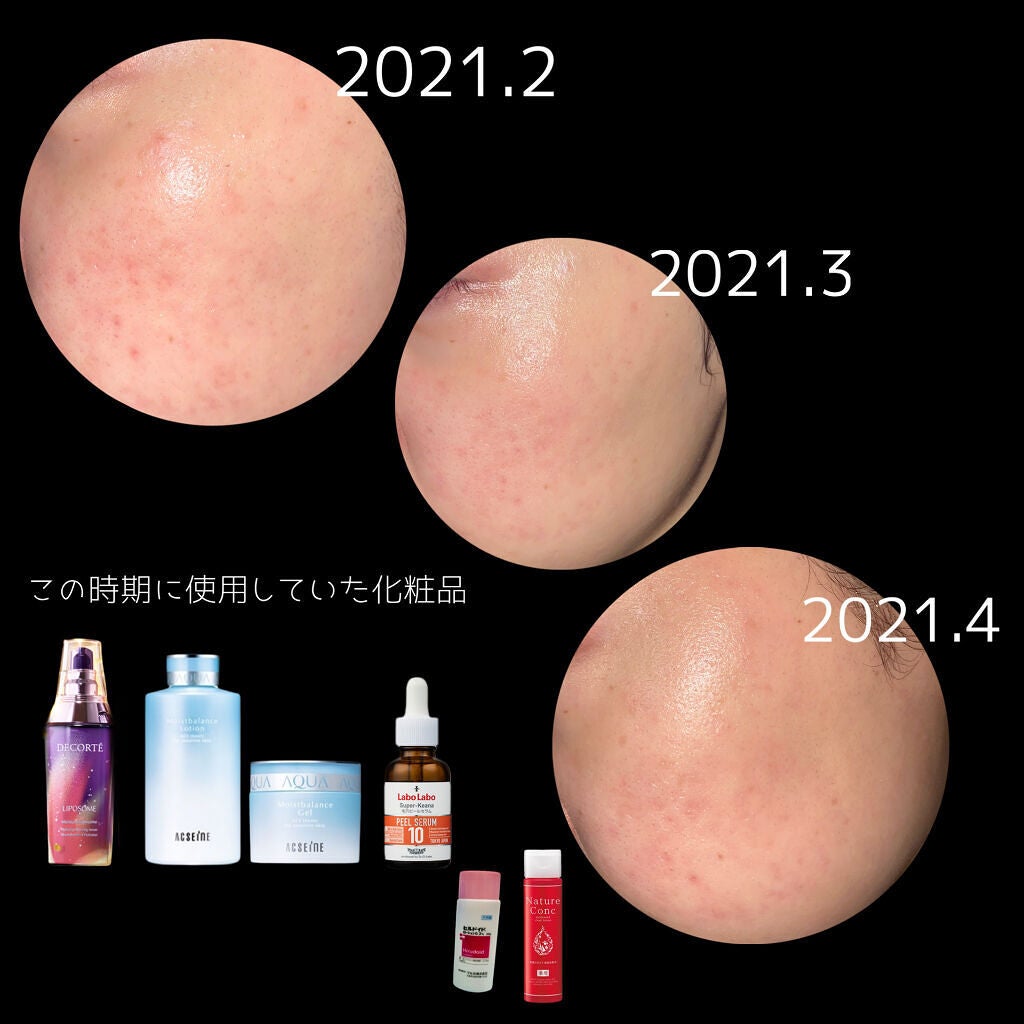 モイストバランス ローション/ACSEINE/化粧水を使ったクチコミ(6枚目)